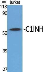 Western blot analysis of various cells using Anti-SERPING1 Antibody