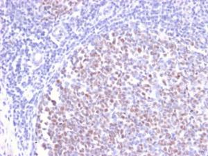 Immunohistochemical analysis of formalin-fixed, paraffin-embedded human tonsil using Anti-Bcl-6 Antibody [BCL6/2497R]