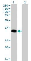 Anti-PHOX2A Mouse Monoclonal Antibody [clone: 4F6]