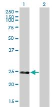 Anti-DGCR6 Mouse Polyclonal Antibody