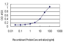 Anti-UNC5B Mouse Monoclonal Antibody [clone: 1A9]