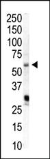 Anti-PIP5K1A Rabbit Polyclonal Antibody