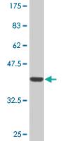 Anti-RCAN1 Mouse Monoclonal Antibody [clone: 1G7]