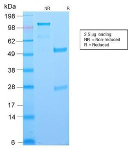 SDS-PAGE analysis of Anti-Bcl-6 Antibody [BCL6/2497R] under non-reduced and reduced conditions; showing intact IgG and intact heavy and light chains, respectively SDS-PAGE analysis confirms the integrity and purity of the antibody