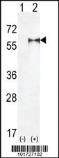 Anti-PIP5K1A Rabbit Polyclonal Antibody