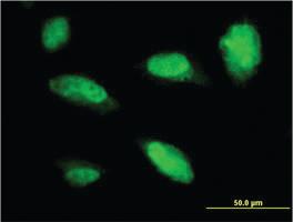 Anti-PHOX2A Mouse Monoclonal Antibody [clone: 4F6]