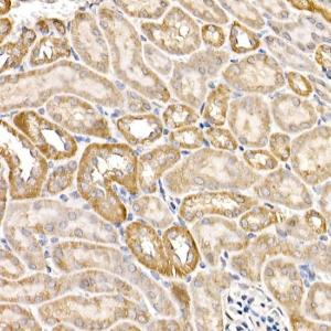 Immunohistochemistry analysis of paraffin-embedded mouse kidney using Anti-FACL4 Antibody (A12025) at a dilution of 1:50 (40X lens). Perform high pressure antigen retrieval with 10 mM citrate buffer pH 6.0 before commencing with IHC staining protocol