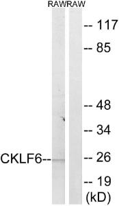 Western blot analysis of lysates from RAW264.7 cells using Anti-CKLF6 Antibody. The right hand lane represents a negative control, where the antibody is blocked by the immunising peptide.