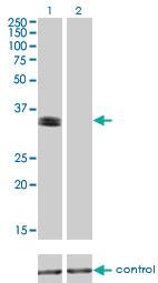 Anti-PHOX2A Mouse Monoclonal Antibody [clone: 4F6]