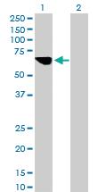 Anti-MLYCD Mouse Polyclonal Antibody