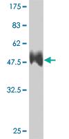 Anti-RCAN1 Mouse Monoclonal Antibody [clone: 1B1]