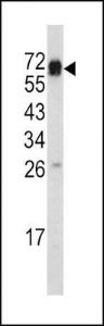 Anti-ENG Rabbit Polyclonal Antibody (APC (Allophycocyanin))