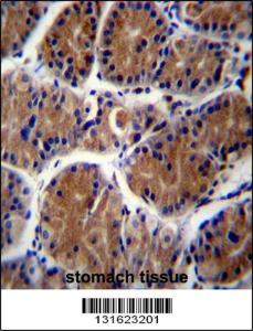 Anti-PCDHA6 Rabbit Polyclonal Antibody (FITC (Fluorescein Isothiocyanate))