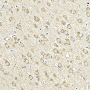 Immunohistochemistry analysis of paraffin-embedded rat brain using Anti-FACL4 Antibody (A12025) at a dilution of 1:50 (40X lens). Perform high pressure antigen retrieval with 10 mM citrate buffer pH 6.0 before commencing with IHC staining protocol