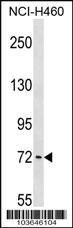 Anti-PCK1 Rabbit Polyclonal Antibody