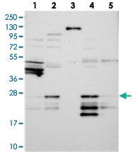 Anti-GFER Rabbit Polyclonal Antibody