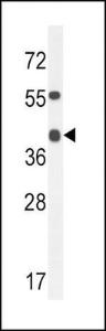 Anti-ADH4 Rabbit Polyclonal Antibody (HRP (Horseradish Peroxidase))