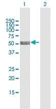 Anti-MLYCD Rabbit Polyclonal Antibody