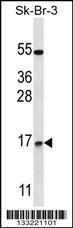 Anti-NRARP Rabbit Polyclonal Antibody (AP (Alkaline Phosphatase))