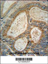 Anti-INSIG1 Rabbit Polyclonal Antibody (HRP (Horseradish Peroxidase))