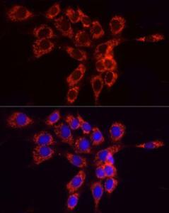 Immunofluorescence analysis of NIH/3T3 cells using Anti-FACL4 Antibody (A12025) at a dilution of 1:50 (40X lens). DAPI was used to stain the cell nuclei (blue)