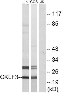 Western blot analysis of lysates from Jurkat and COS cells using Anti-CKLF3 Antibody. The right hand lane represents a negative control, where the antibody is blocked by the immunising peptide.