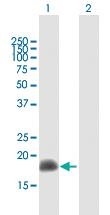 Anti-ARL2 Mouse Polyclonal Antibody