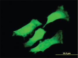 Anti-IL6 Mouse Monoclonal Antibody [clone: 4B12]