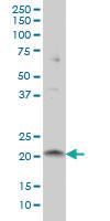 Anti-ITGB3BP Mouse Monoclonal Antibody [clone: 3F6]