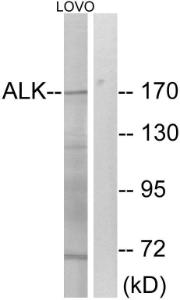 Western blot analysis of lysates from LOVO cells using Anti-ALK Antibody. The right hand lane represents a negative control, where the antibody is blocked by the immunising peptide.