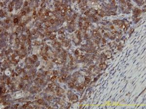 Anti-CCT5 Mouse Monoclonal Antibody [clone: 4E5-4B1]