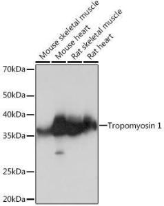 Western blot analysis of extracts of various cell lines, using Anti-Tropomyosin 1 (alpha) Antibody [ARC1283] (A306724) at 1:1,000 dilution