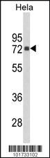 Anti-PIP5K1C Rabbit Polyclonal Antibody