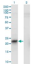 Anti-ITGB3BP Mouse Monoclonal Antibody [clone: 3F6]