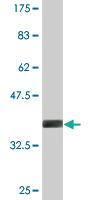 Anti-ADAM20 Mouse Monoclonal Antibody [clone: 4B10]