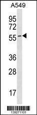 Anti-ESAM Rabbit Polyclonal Antibody (FITC (Fluorescein Isothiocyanate))