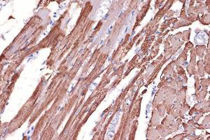 Immunohistochemistry analysis of paraffin-embedded rat heart using Anti-Tropomyosin 1 (alpha) Antibody [ARC1283] (A306724) at a dilution of 1:100 (40X lens). Perform microwave antigen retrieval with 10 mM Tris/EDTA buffer pH 9.0 before commencing with IHC staining protocol