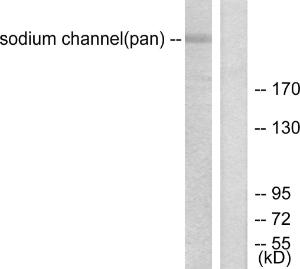 Antibody anti-SODIUM CHANNEL-PAN 100 µg