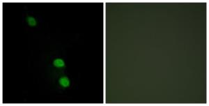 Immunofluorescence analysis of HepG2 cells using Anti-TEAD2 Antibody The right hand panel represents a negative control, where the antibody was pre-incubated with the immunising peptide