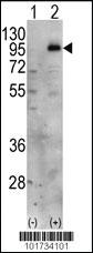 Anti-PIP5K1C Rabbit Polyclonal Antibody