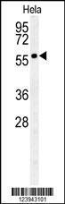 Anti-GALNT4 Rabbit Polyclonal Antibody (APC (Allophycocyanin))