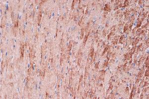 Immunohistochemistry analysis of paraffin-embedded mouse heart using Anti-Tropomyosin 1 (alpha) Antibody [ARC1283] (A306724) at a dilution of 1:100 (40X lens). Perform microwave antigen retrieval with 10 mM Tris/EDTA buffer pH 9.0 before commencing with IHC staining protocol