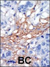 Anti-PIP5K1C Rabbit Polyclonal Antibody