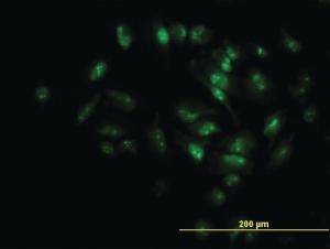 Anti-MPHOSPH10 Mouse Monoclonal Antibody [clone: 1B10]