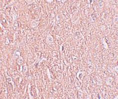 Anti-LRRTM2 Rabbit Polyclonal Antibody