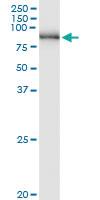 Anti-PNPT1 Polyclonal Antibody Pair