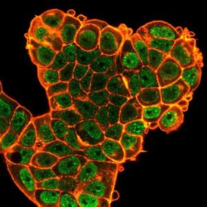 Immunofluorescent analysis of PFA-fixed MCF-7 cells stained with Anti-Bcl-6 Antibody [PCRP-BCL6-1D3] followed by Goat Anti-Mouse IgG (CF&#174; 488) (Green). CF&#174; 640A Phalloidin (Red)