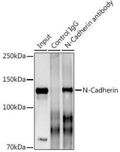 Immunoprecipitation analysis of 600µg extracts of mouse brain using 3 µg of Anti-N Cadherin Antibody (A305590). This Western blot was performed on the immunoprecipitate using Anti-N Cadherin Antibody (A305590) at a dilution of 1:1000