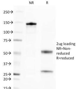 SDS-PAGE analysis of Anti-BCMA Antibody [BCMA/2366] under non-reduced and reduced conditions; showing intact IgG and intact heavy and light chains, respectively. SDS-PAGE analysis confirms the integrity and purity of the antibody