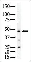 Anti-PIP4K2A Rabbit Polyclonal Antibody